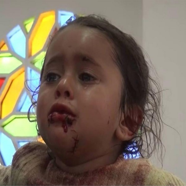 الامم المتحدة تدعو إلى محاسبة المسؤولين عن مذبحة مخيم المزرق في” اليمن “
