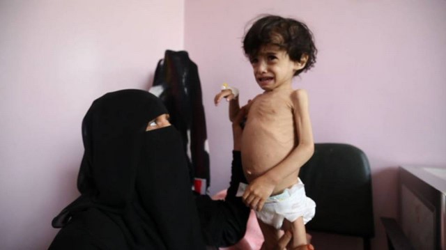 منظمات محلية ودولية تدين بقوة الحصار عل اليمن